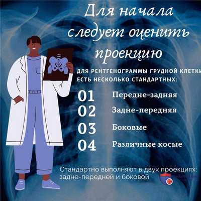 Как считать ребра на рентгенограмме грудной клетки