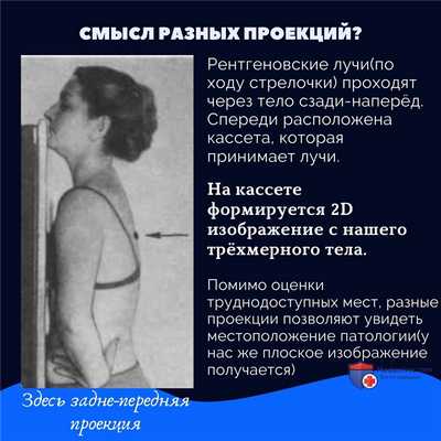 Как считать ребра на рентгенограмме грудной клетки