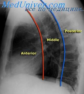 рентгенография средостения