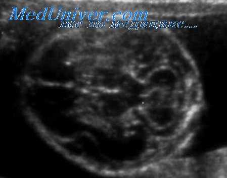 рентгенография основания черепа