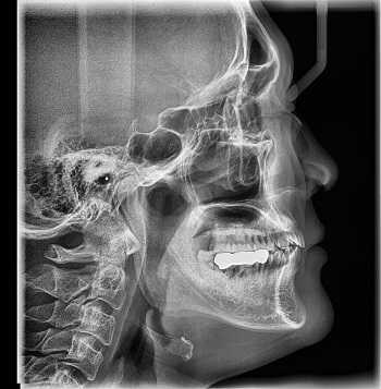 Запись снимков МРТ на пленку или CD-диск