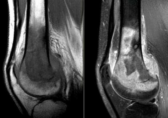 анат.плеча-обраб