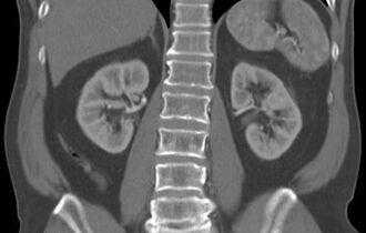 МРТ почек - подготовка к исследованию, как делают