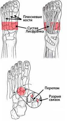 анатомия стопы