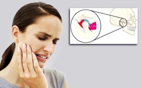 Ювенильный идиопатический артрит височно-нижнечелюстного сустава (ВНЧС) - лучевая диагностика