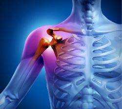 КТ плечевого сустава фото