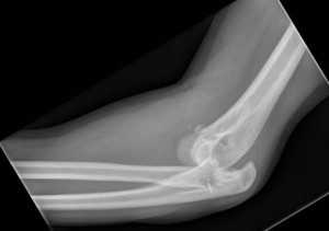 страшная триада-обр