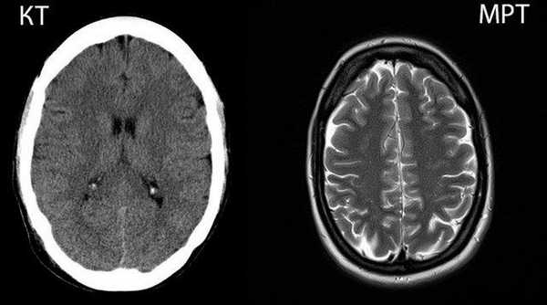 МРТ-КТ-отличия на снимках