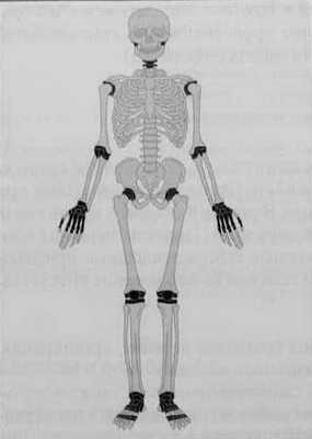 Снимки МРТ и КТ. Ревматоидный артрит - болезнь Стила