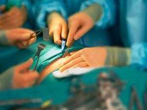 Хирургическое лечение лейомиомы желудка