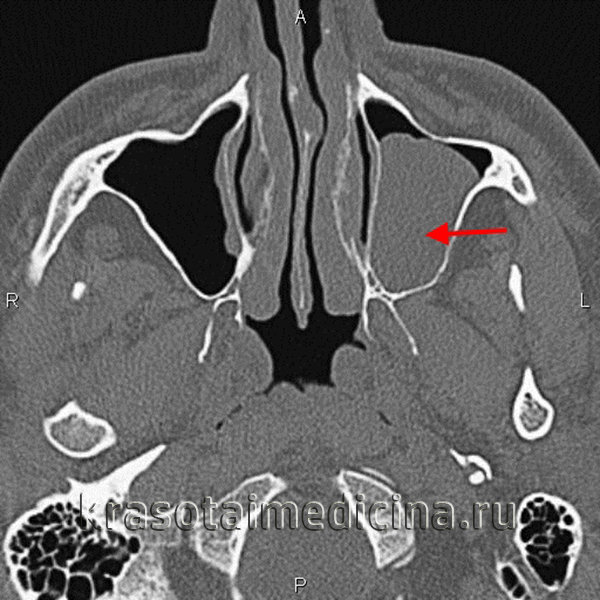 Нагорная Оксана Александровна, лор, хирург - Красноярск