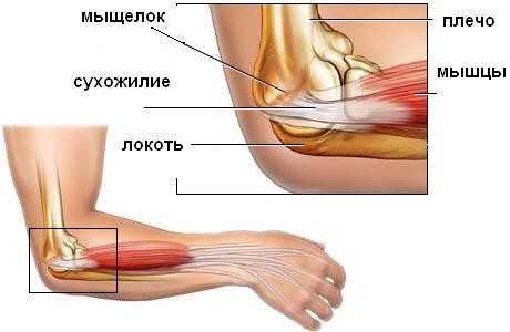 Латеральный эпикондилит анатомия