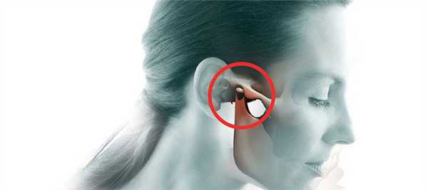 Рентген ВНЧС