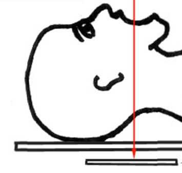 Снимок через рот-схема