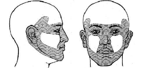 «Лицевая маска» – зоны повышенного рискарецидивирования и метастазирования БКК