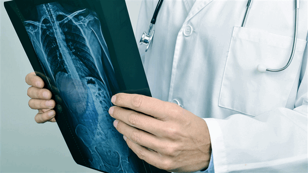 Лечение гемангиомы позвонка