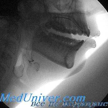 произношение гласных