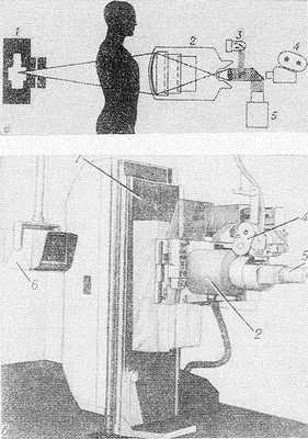 Принципиальная схема (а) и внешний вид (б) рентгенодиагностического аппарата с системой для рентгенокинематографии: 1 — рентгеновская трубка; 2 — электронно-оптический преобразователь; 3 — фотоэкспонометр; 4 — кинокамера; 5 — телевизионная камера; 6 — видеоконтрольное устройство; 7 — опорная стенка штатива.