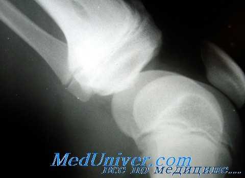 рентгенологическое исследование суставов