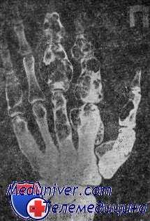 рентгенограмма костей