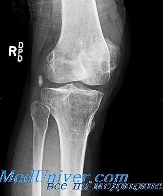 рентгеноостеология