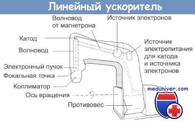 Линейный ускоритель