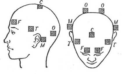 Рис. 21. Схема расположения электродов при реоэнцефалографии 
