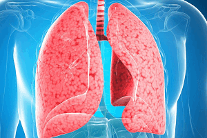 Респираторный дистресс-синдром