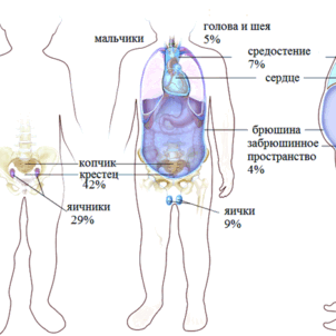 Герминогенные опухоли у детей