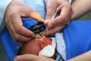 Лечение ретинопатии недоношенных в Москве