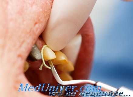 ретракция десны