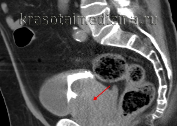 Владимиров Роман Робертович, уролог - Москва
