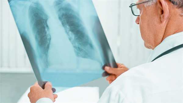 retsidiv-raka-legkogo