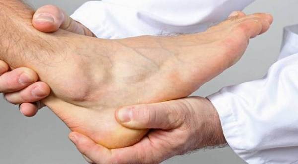 Артрит голеностопного сустава