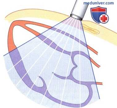 Физические принципы эхокардиографии (ЭхоКГ)