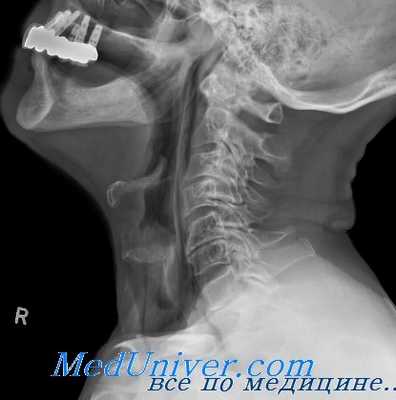 глотка в формировании голоса