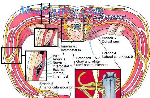 блокада межреберных нервов