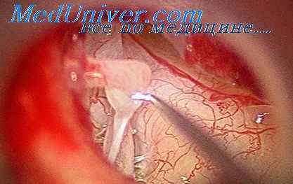 мобилизация стремени