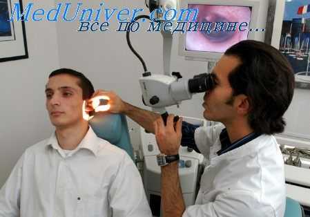 фенестрация при отосклерозе