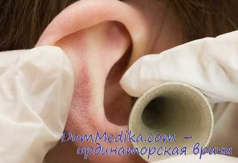 фенестрация лабиринта