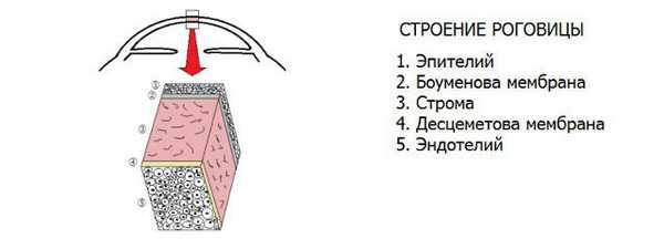 Дистрофии роговицы глаза: эпителиальные и эндотелиальные