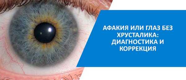 афакия глаза