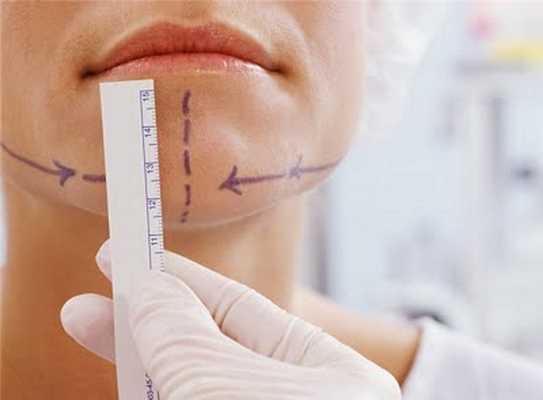 ментопластика подбородка.jpg