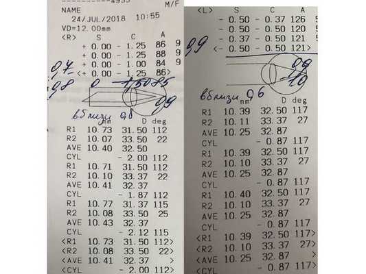 Зрение после операций