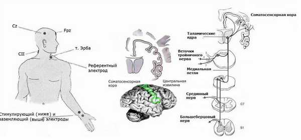 Принцип ССВП с верхних и нижних конечностей
