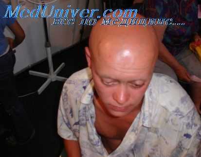 лучевая болезнь