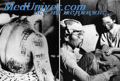 коллагеновые волокна