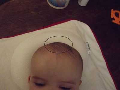 Родничок у младенца