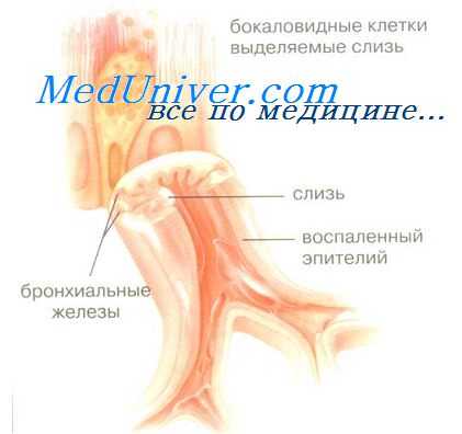 бронхи при воспалении