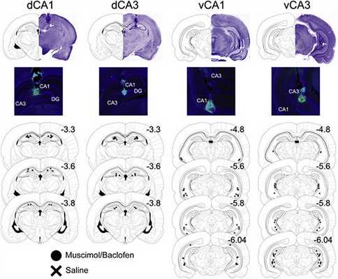активность нейронов